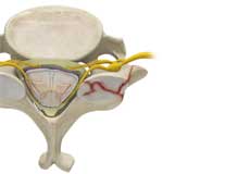 Cervical Fracture