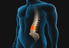 Degenerative Spine Surgery