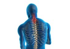 Neck Strains and Sprains