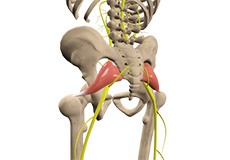 Piriformis Syndrome