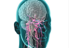 Trigeminal Neuralgia